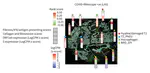 Profiling of lung SARS-CoV-2 and influenza virus infection dissects virus-specific host responses and gene signatures